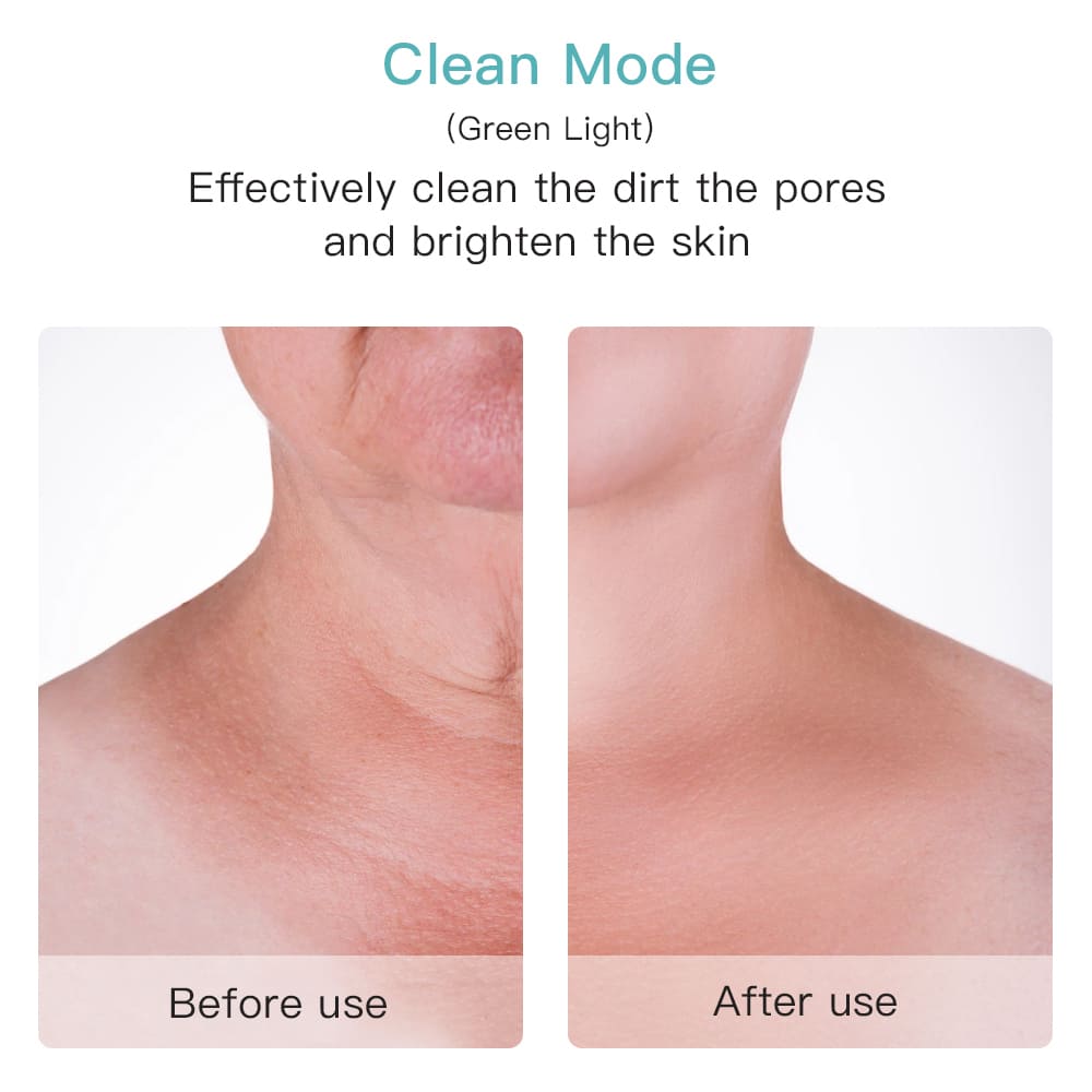 Effektiv porerens i ansiktet eller på halsen før etter
